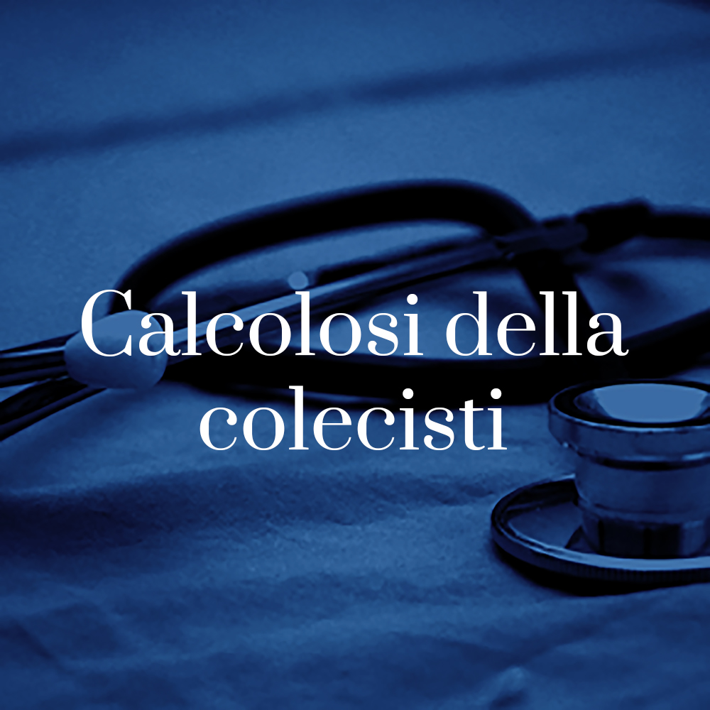 patologia calcolosi della colecisti